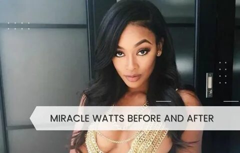 Miracle Watts Before And After: Know Everything About Her Su