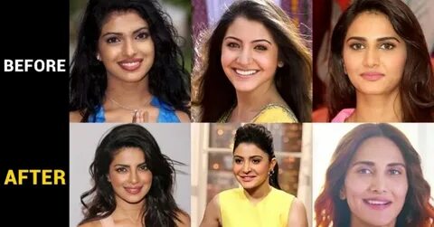 Bollywood actresses who have undergone Plastic surgery till