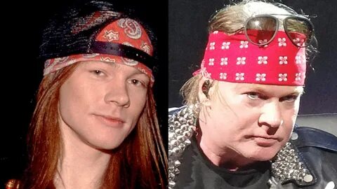 Axl Rose -- Good Genes or Good Docs?