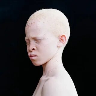 20 неземных людей-альбиносов, поражающих своей внешностью