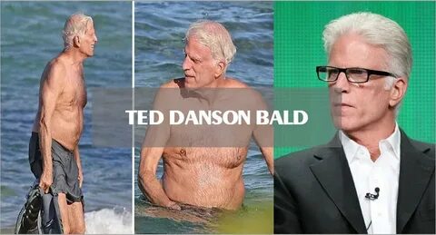 "Is Ted Danson Bald?": Surprising Answer Revealed And 5 Solu