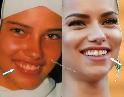 Did Adriana Lima Have Plastic Surgery? (Before & After 2020)