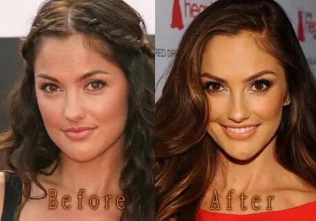 Minka Kelly Plastic Surgery