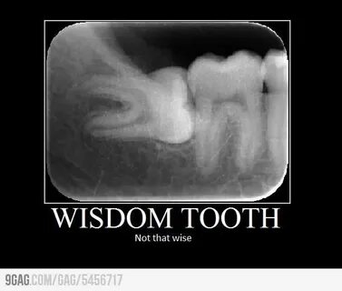My wisdom tooth Dental humor, Dentist humor, Dental jokes