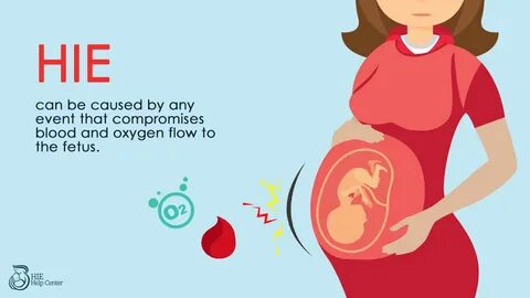 What causes oxygen deprivation and HIE in your baby? 
