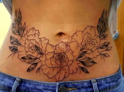 Tummy Tuck Tattoo Cover Ups Pictures (41) " Tummy Tuck: Pric