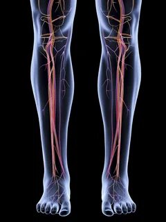 Optimizing Lipid Control for Lower Extremity Peripheral Arte