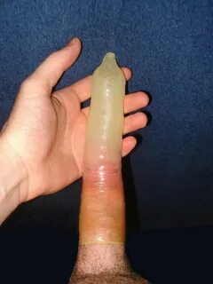 Prostitutes Spunk Filled Condom - Nude Gallery - Porn Photos