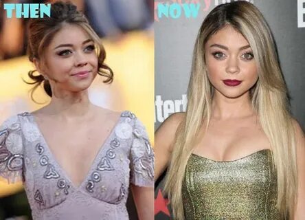 Sarah Hyland Plastic Surgery Boob Job (Breast Implant), Fact