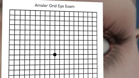 Gallery of amsler grid chart 2 bedowntowndaytona com - amsle