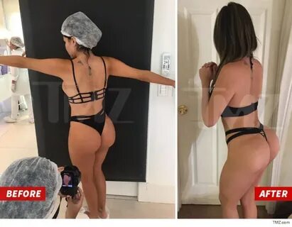Model Liziane Gutierrez Gets Kim K.'s Ass in Surgery!