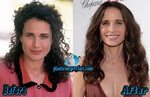 Andie Macdowell Archives - Plastic Surgery Facts