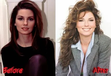Shania Twain Before and After Plastic Surgery Plastic surger