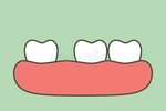 Spaced Teeth Cartoon - Get Images
