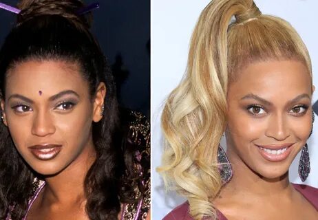 Beyonce Knowles Plastic Surgery - With Before And After Phot
