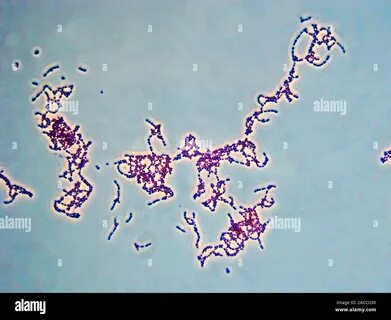 Streptococcus pyogenes bacteria, light micrograph. These are