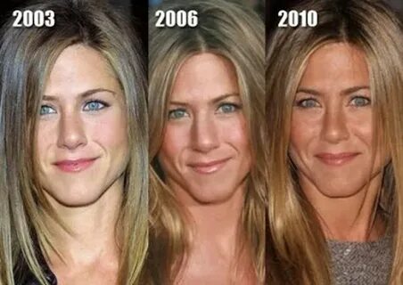 Jennifer Aniston’s Face: The Most Requested Celebrity Look I