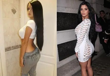 Demi Rose Plastic Surgery - Celebrities plastic surgery