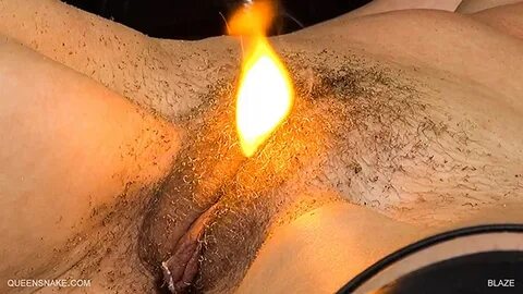 Burning sensation vagina - Pic Porn