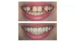 Albert Lea Dentist- Dental Implants Albert Lea, MN 507-377-5