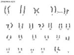 Downloading Karyotype Analysis Worksheet Answers Worksheet L