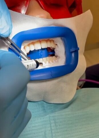 Stomatologiya klinikasi Vita Dent Digital dentistry, , foto