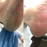 Natalia Maltseva Foot Care Center (Perm, Arkadiya Gaydara Street, 3), podology