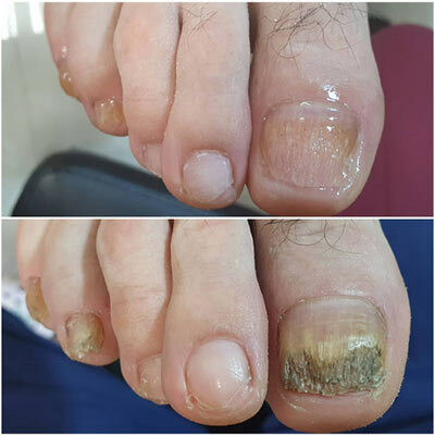 Podology PodoEstetic, Antalya, photo