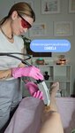 VseVlaser (derevnya Kaltino, Pesochnaya ulitsa, 30) ، إزالة الشعر