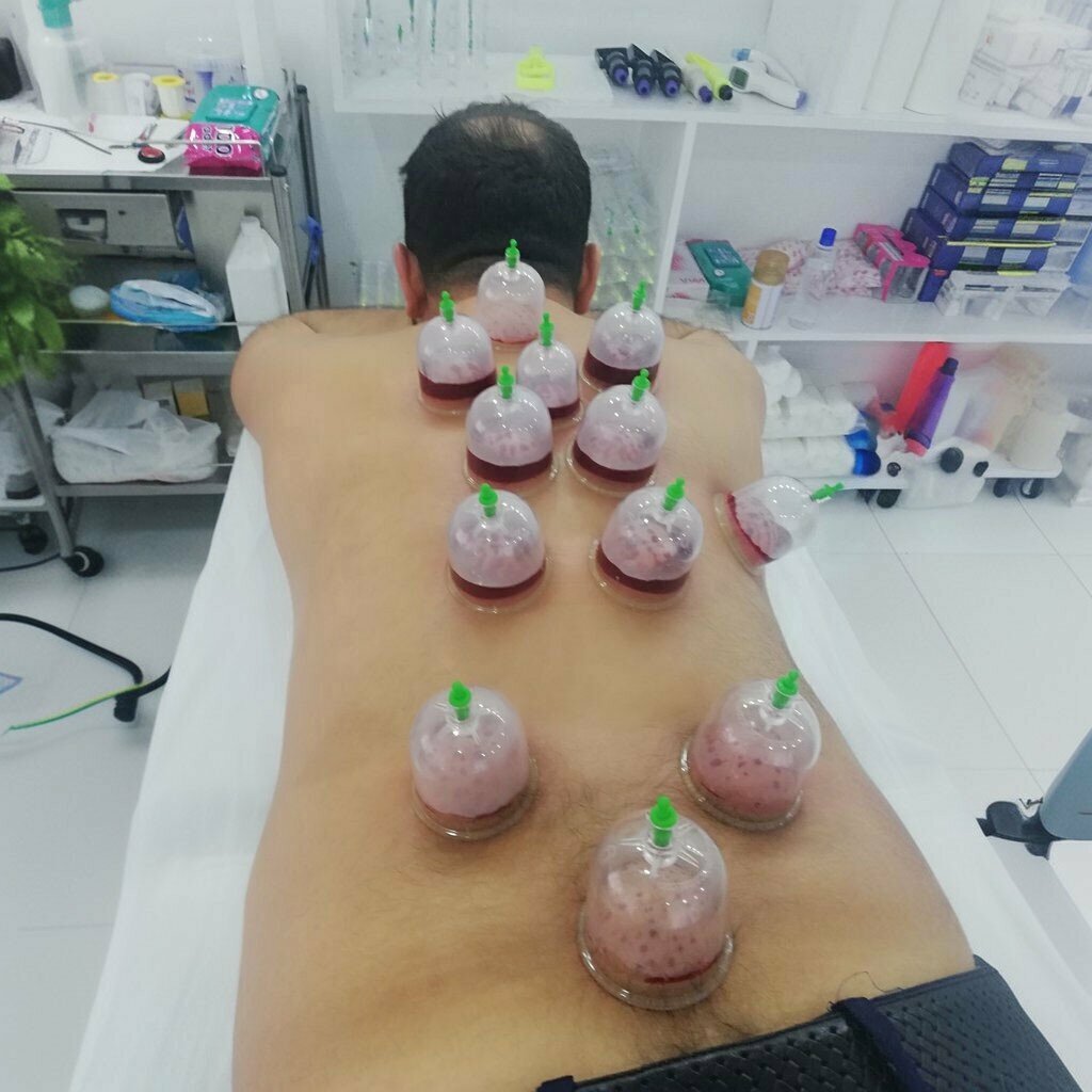 Alternative medicine Malatya Anatolian Cupping Getat Association Malatya Branch, Malatya, photo