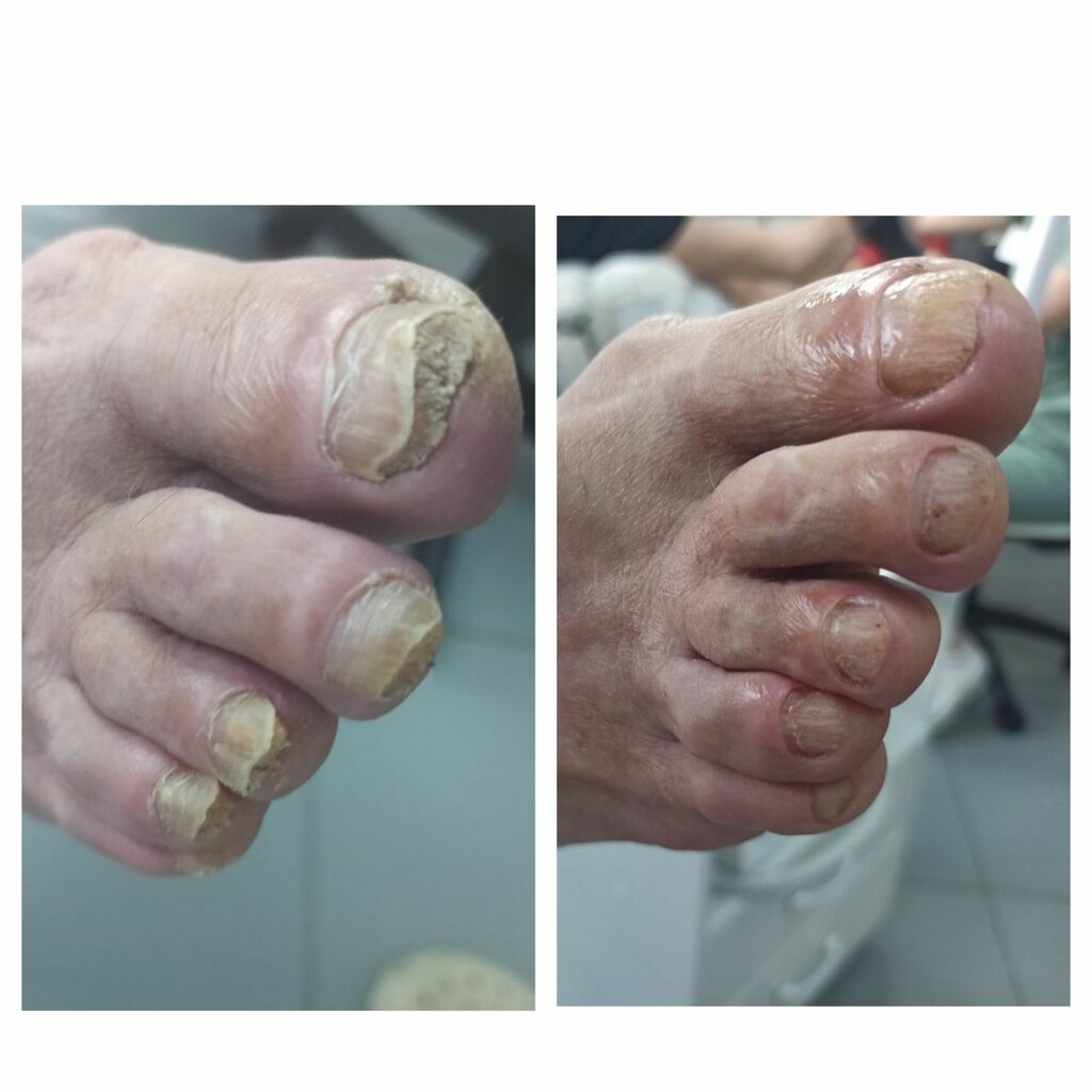 Подология Подолог+, Краснодар, фото