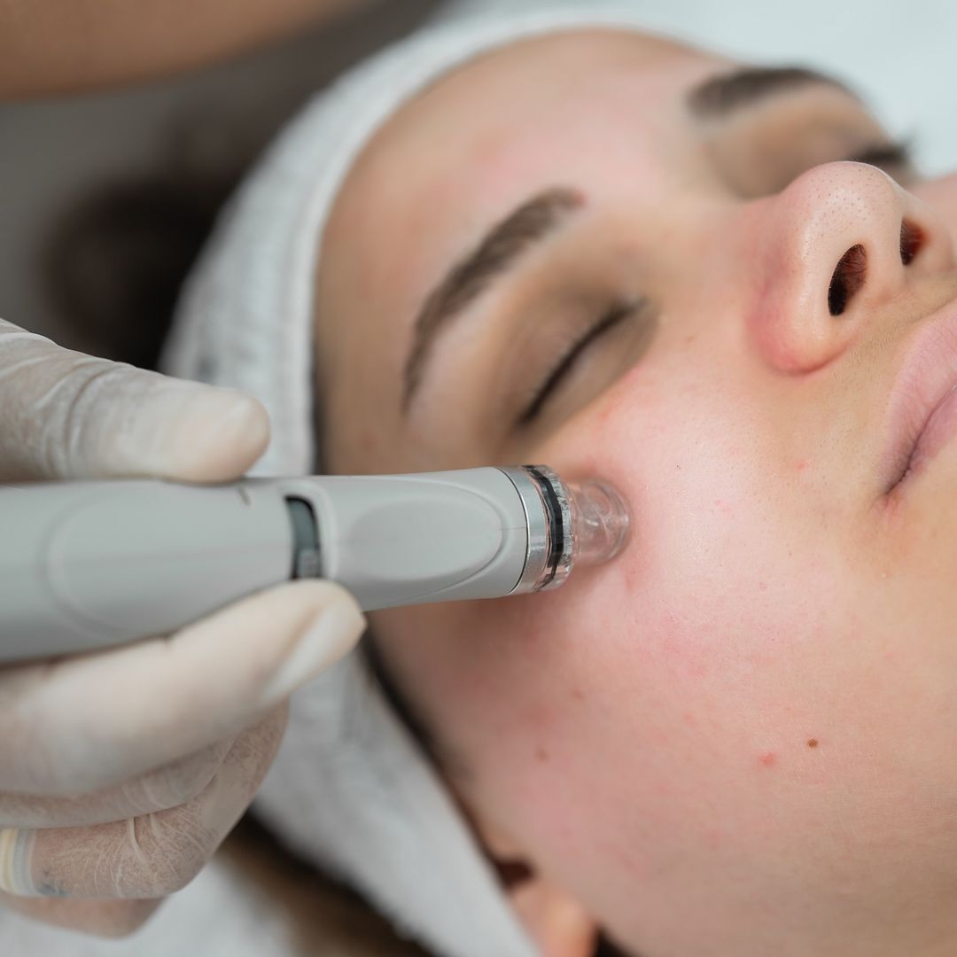 Arinna Beauty Kadıköy Güzellik Merkezi - Lazer Epilasyon - Cilt Bakım - Dermapen - Altın İğne - Mezoterapi - Arinna Beauty