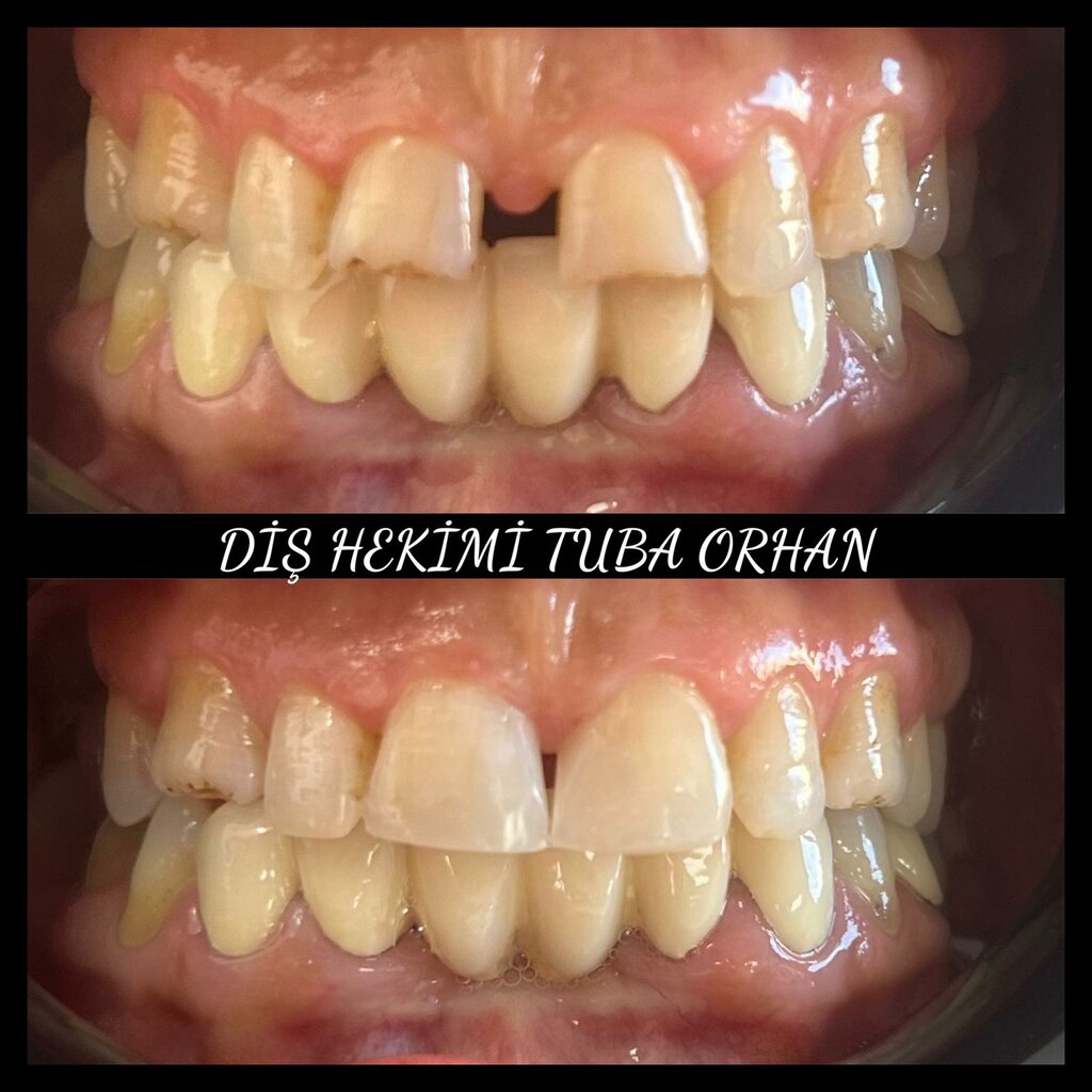 Dental clinic Dentist Tuba Kucuk Orhan, Korfez, photo