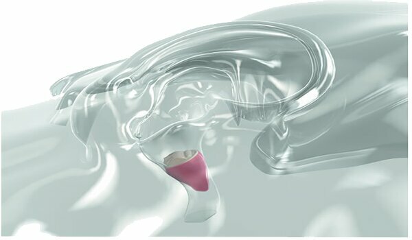 Hearing aids Tone Hearing Aids, Manavgat, photo