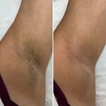Laserlux (mikrorayon Tyoply Beton, Opticheskiy Lane, 1А), hair removal