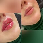 Flax (Krutitskaya Street, 14А), cosmetology