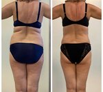 BodySculpt (Molodyozhnaya Street, 5), cosmetología