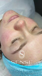 Sense (Varfolomeevskaya Street, 6), cosmetology