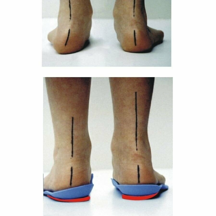 علم دراسة التربة Podology and Aesthetics Center Ozerovoy M. ، ، صورة