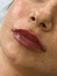 Chernika-laser (Bazarny pereulok, 4) ، علم التجميل