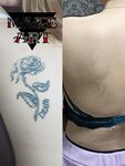 Лазерное удаление тату татуажа (Vereskovaya ulitsa, 15к2) ، أوشام