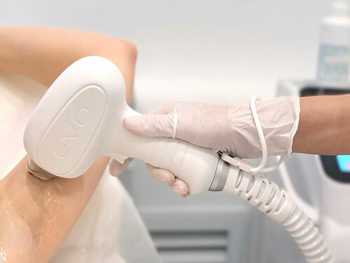 Epilasyon Loka, Voronej, foto