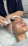 Laseri (Minskaya Street, 2А) ، إزالة الشعر