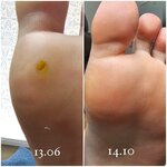 MedStopy (Krasnodar, ulitsa Repina, 1/2к1), podology