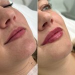 LuA. Clinic (Kolomyazhskiy Avenue, 5к3), cosmetology