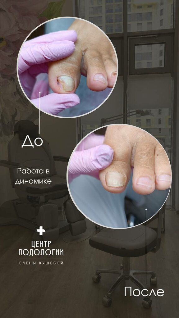 علم دراسة التربة Elena Kusheva Podology Center ، ، صورة
