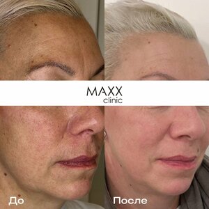 Maxx Clinic (Малая Бронная ул., 19А), косметология в Москве