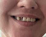 Stomatologiya Dents plyus (ulitsa Radiosvyazi, 26/1) ، عيادات الأسنان