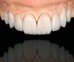 High Light Dental Laboratory (Essque Hotels, Al Barsha 1, Al Barsha, Hadaeq Mohammed Bin Rashid, Dubai), dental laboratory