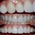 Дубровины (Юбилейный просп., 1, корп. 3, Химки), стоматологическая клиника в Химках